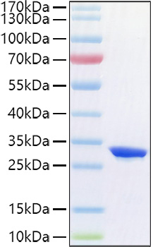 Recombinant Human Complement factor D/CFD Protein