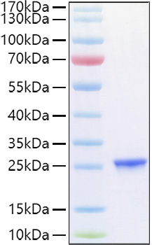 Recombinant Human TIMP-2 Protein