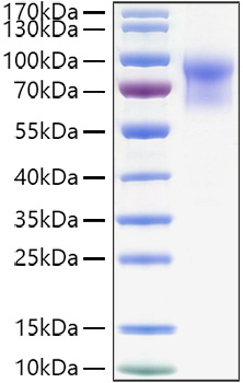 Recombinant Mouse IL-15RA/CD215 Protein