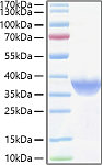 Recombinant Human FR-alpha/FOLR1 Protein (RP01379)