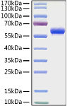Recombinant Human Fc-gamma RIIa/CD32a(H167R) Protein (RP01383)