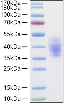 Recombinant Human NKAT-2/KIR2DL3/CD158b2 Protein