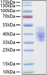 Recombinant Human NKAT-2/KIR2DL3/CD158b2 Protein (RP01389)