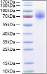 Recombinant Human Osteoactivin/GPNMB Protein (RP01390)