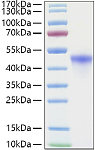 Recombinant Human VSIG4 Protein (RP01391)