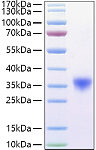 Recombinant Mouse Fc-gamma RIV/CD16-2 Protein (RP01394)