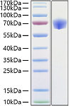 Recombinant Mouse TNFRSF1B/TNF-R2/CD120b Protein (RP01395)
