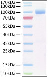 Recombinant Human IL-6RA/CD126 Protein (RP01396)