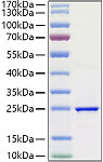 Recombinant Human FGF-3 Protein (RP01404)