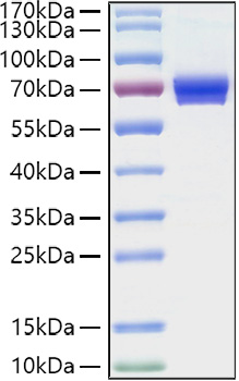 Recombinant Human IL-2-RA/CD25  Protein