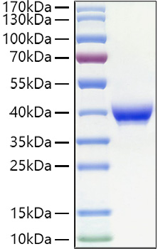 Recombinant Human Fc epsilon RII/CD23 Protein