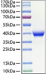Recombinant Human Fc epsilon RII/CD23 Protein (RP01407)