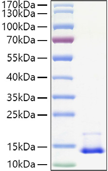 Active Recombinant Human CCL2/MCP-1 Protein