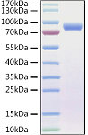 Recombinant Human Endoglin/CD105 Protein (RP01413)
