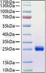 Recombinant Human Ephrin-A1/EFNA1 Protein (RP01419)