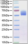Recombinant Human BMPR-2 Protein (RP01420)