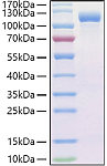 Recombinant Human Endoglin/CD105 Protein (RP01423)