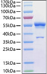 Recombinant Human Ephrin-A1/EFNA1 Protein (RP01425)