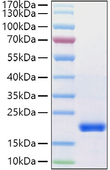 Recombinant Human VEGF-D/FIGF Protein