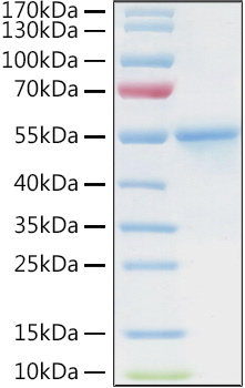 Recombinant Human Carbonic anhydrase 9 Protein
