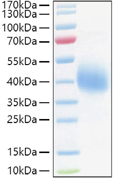 Recombinant Human TFPI Protein