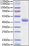 Recombinant Human Apolipoprotein A-II/APOA2 Protein (RP01441)