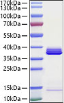 Recombinant Human Apolipoprotein E/ApoE Protein (RP01443)