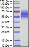 Recombinant Human WAIF1/5T4/TPBG Protein (RP01445)