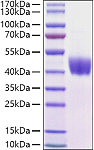 Recombinant Mouse Mesothelin/MSLN Protein (RP01448)