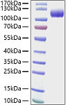 Recombinant Human gp140/CDCP1/CD318 Protein (RP01450)
