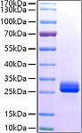 Recombinant Human GSTA1 Protein (RP01456)