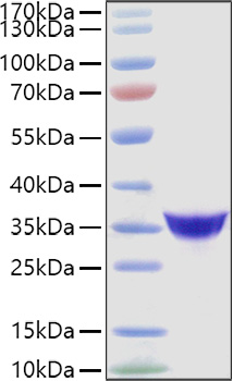 Recombinant Human Adiponectin/Acrp30/ADIPOQ Protein