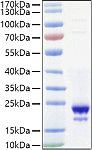 Recombinant Mouse IL-10 Protein (RP01465)