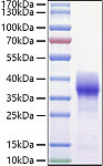 Recombinant Mouse Basigin/CD147 Protein (RP01467)
