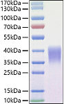Recombinant Mouse Ephrin-B2/EFNB2 Protein (RP01468)