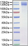 Recombinant Mouse OSMR/IL-31RB Protein (RP01471)