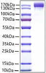 Recombinant Mouse VEGFR-2/KDR/CD309 Protein (RP01483)