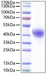Recombinant Human DC-SIGN/CD209 Protein (RP01489)