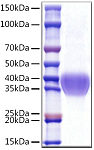 Recombinant Human GOLPH2/GOLM1 Protein (RP01505)
