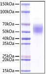 Recombinant Human KLRG1/CLEC15A/CD369 Protein (RP01521)