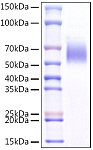 Recombinant Mouse IL-1RL1/ST2 Protein (RP01538)