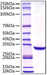Recombinant Human PSA/KLK3 Protein (RP01540)