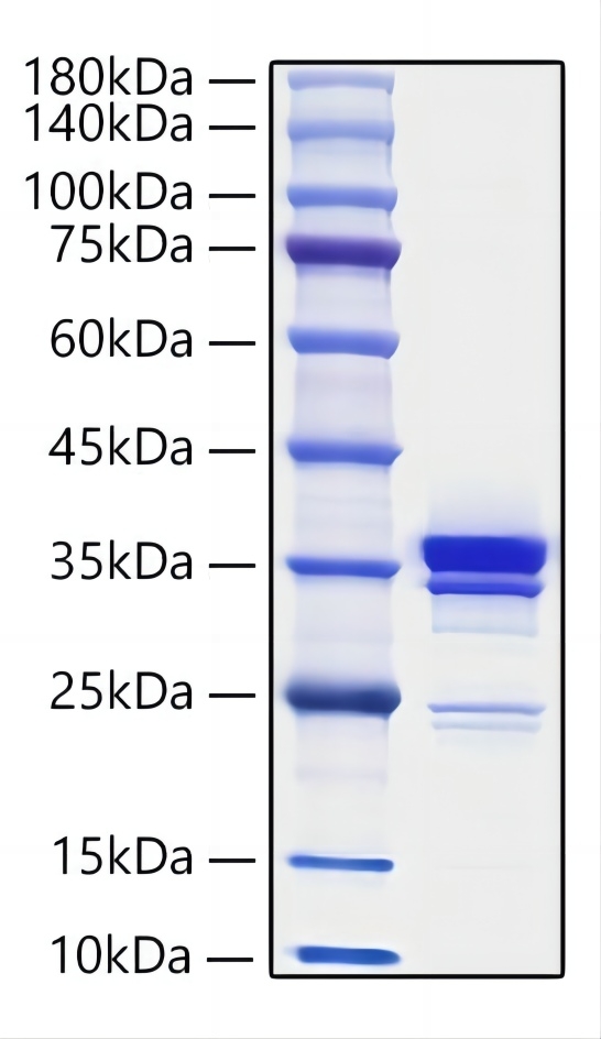 Recombinant Mouse HMGB1 Protein