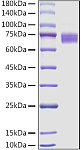 Recombinant Mouse Fc-epsilon RI-alpha/FCER1A Protein (RP01553)