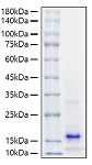 Recombinant Mouse Parathormone/PTH Protein (RP01578)