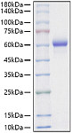 Recombinant Mouse Asparaginyl endopeptidase/Legumain Protein (RP01579)