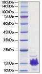 Recombinant Human Parathormone/PTH Protein (RP01587)