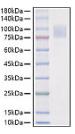 Recombinant Mouse IL-17RA/CD217 Protein (RP01592)