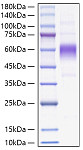 Recombinant Monkeypox virus B16R Protein (RP01594)