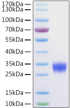 Recombinant Human IL-4 Protein